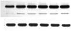 Effets of DAS, CAP, GGR n SFN on the expression of oxitive stress mrkers, pikbα (A), NFkB (B), TNFα (C) ginst -pretrete HepG2 ells. Atin levels were ompre to ensure equl mount of protein loing.