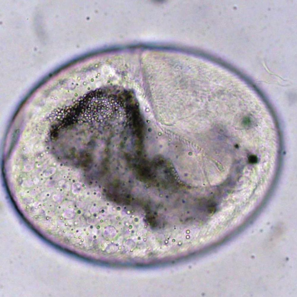 Exorchis oviformis metacercariae and Metacercaria hasegawai were found from Z. platypus (9 and 7 fishes, respectively).