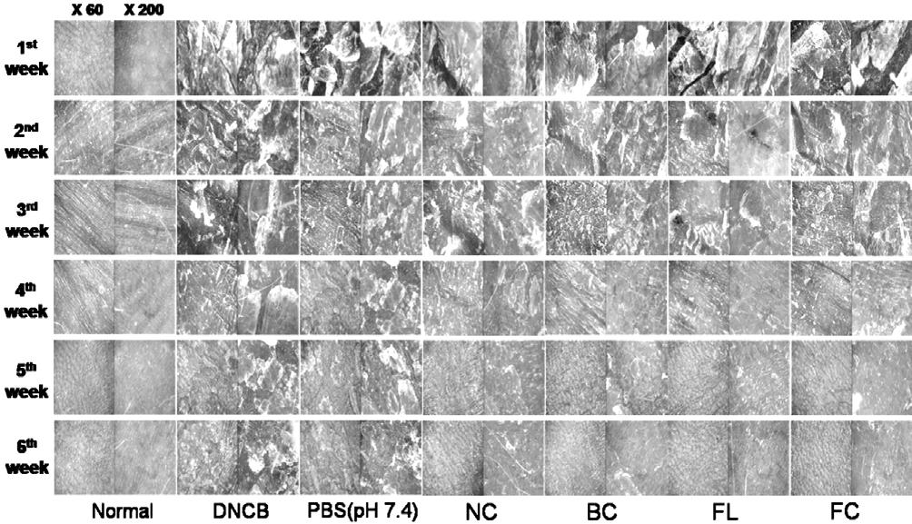94 권택관 임건빈 김진철 Figure 2. Effect of Anti-atopic dermatitis preparations on dorsal skin appearance of DNCB-applied hairless mice.