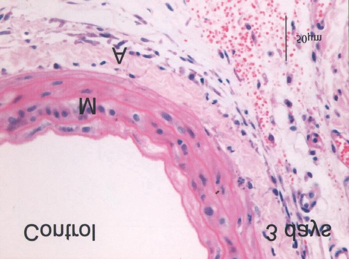 : example of mild injury 14 days after balloon overstretch in rat carotid artery.