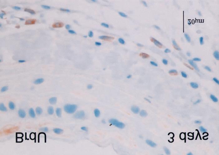 large number of adventitial cells was noted in a control artery () whereas everolimus-treated artery showed few