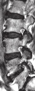 T2-weighted sagittal and