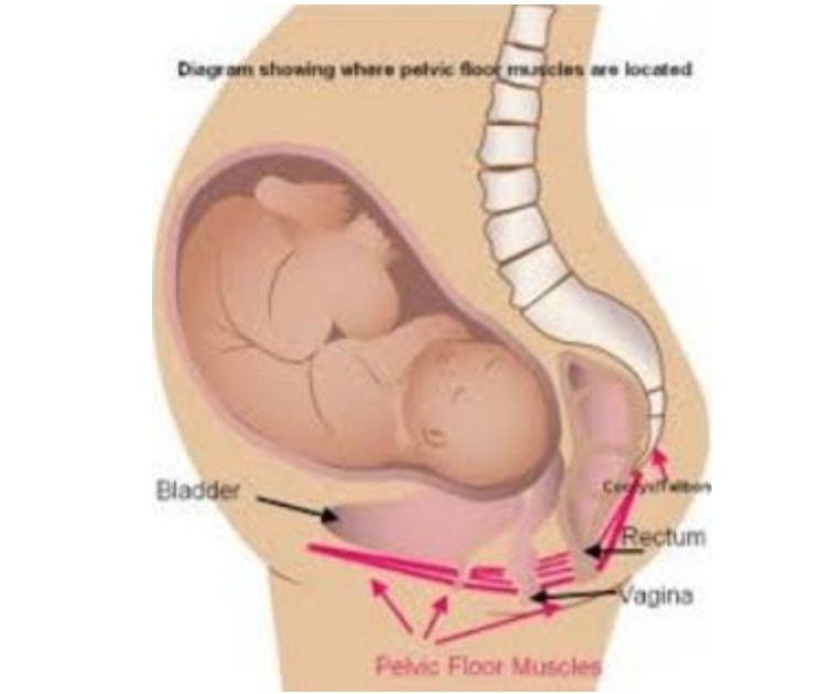 임산부의골반통증은릴락신이라는호르몬영향으로골반인대와관절을유연하게하면서발생합니다.