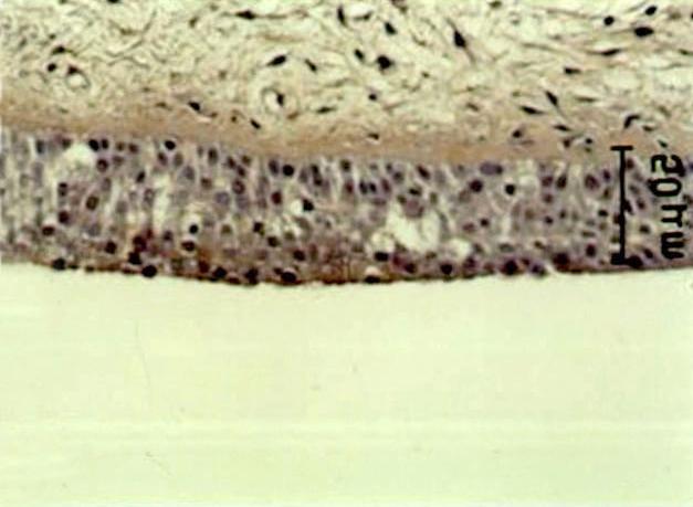 15-LO는 섬모상피세포와 기저세포의 세포질에서 강하 A B 사람 정상 코점막 상피세포에서 분화 양상 및 정도에 따 른 15-LO와 COX-2의 발현 사람 정상 코점막 상피세포를 섬모 상피세포로 분화시 C D Fig. 1. Expression of 15-lipoxygenase and cyclooxygenase-2 in human nasal mucosa.