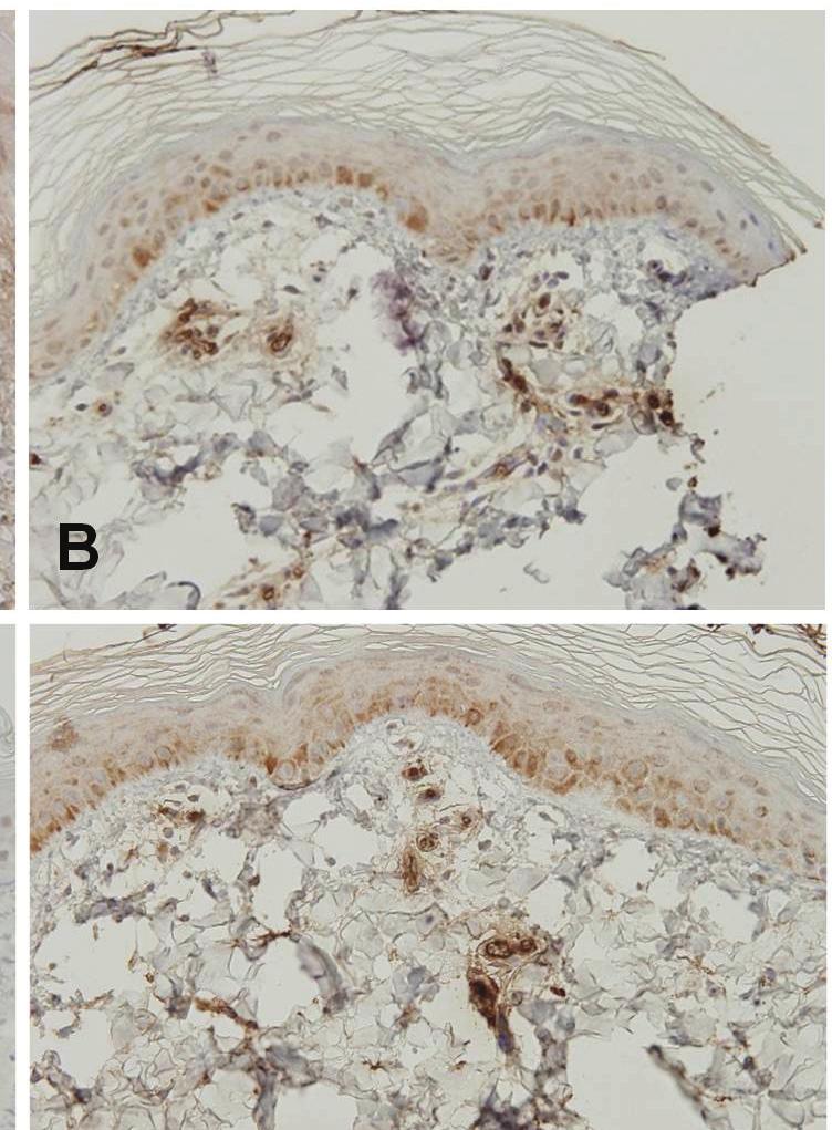 COX-2 expression in the gamma irradiated epidermis of mini-pig skin shows a tendency to increase