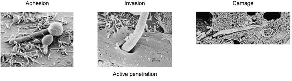 Cellular Microbiology 2010;12:273-282).