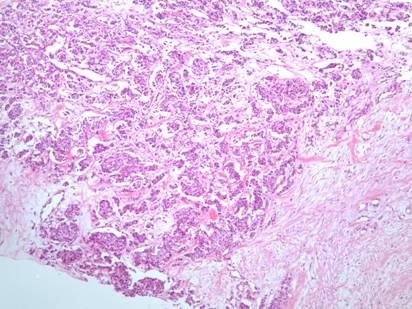 - Jung Min Roh, et al. A case of breast cancer in a patient with multiple endocrine neoplasia type 2 - 험하였기에문헌고찰과함께보고한다.