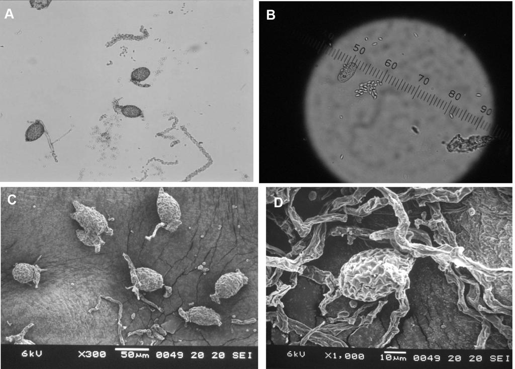 김지영 이왕휴 김형무 212 Fig. 1. The morphological features of Ampelomyces pycnidia and pycnidiospores observed by an optical microscope and a scanning electron microscope.