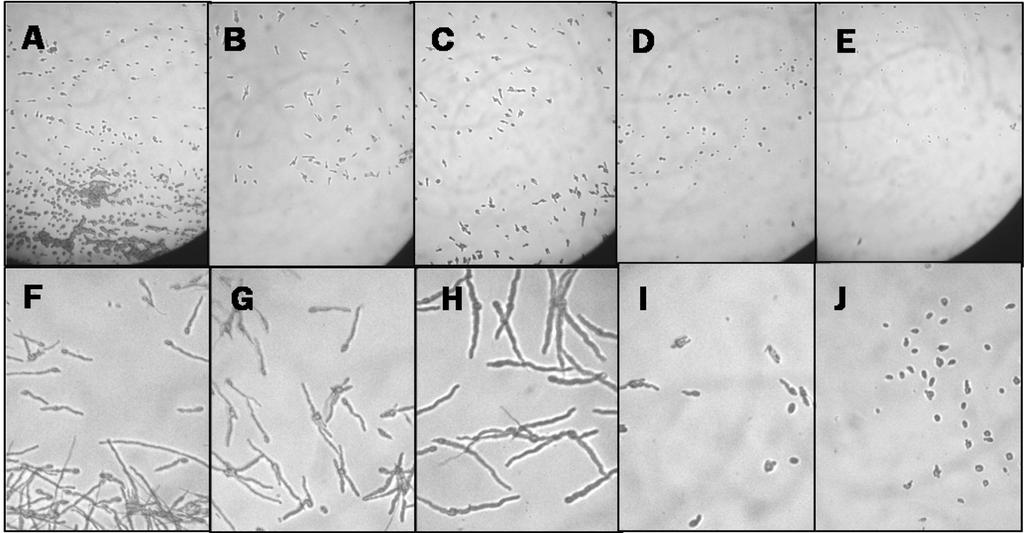 김지영 이왕휴 김형무 214 Fig. 2. The germination degree of Na2 by NaCl concentration (A, B, C, D and E = l horizontal line indicates 24 hours after incubation.