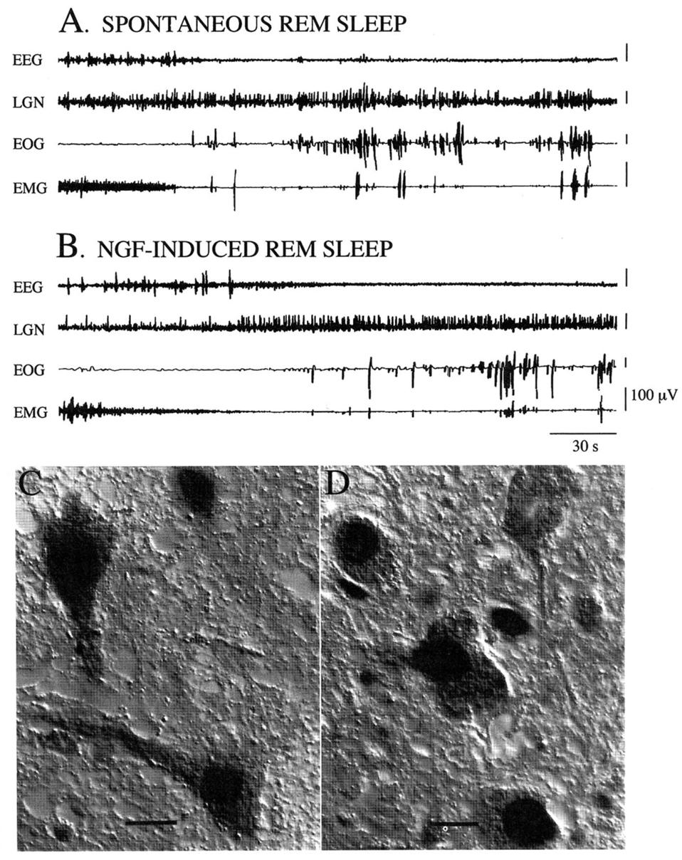 18 렘수면에서중요한역할을담당하는 NPO 신경원에 neurotrophinergic input을담당하는신경해부학적구조는 NPO로투사하는 dorsolateral mesopontine tegmentum 의콜린성신경원이다. 이신경원은 neurotrophins을함유하고있으면서 NPO 신경원을자극하여렘수면을유도하는역할을담당한다.