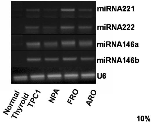 - 조영석외 5 인 : 갑상선암에서 mirna 146a/b, 221 및 222 의발현에대한연구 - 후, pre-mirna-146a/b, pre-mirna-221 및 pre-mirna-222 의발현정도를 RT-PCR을통하여확인하였다. 생성된 RT-PCR 산물을 Gel Pro Analyzer 3.
