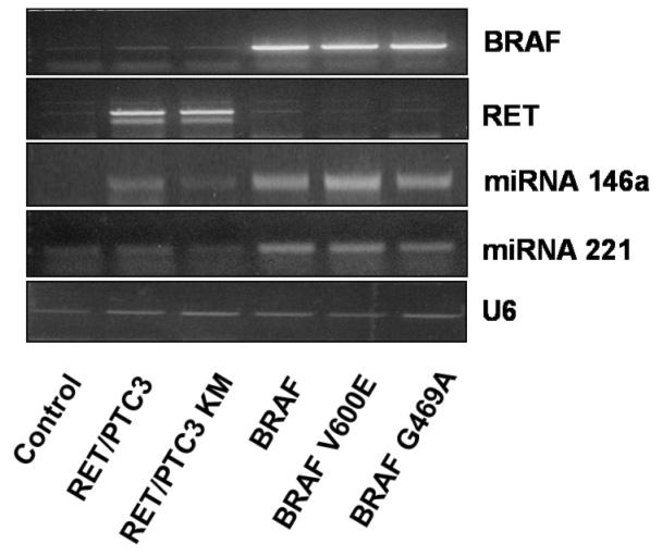 Differential expression of mirna in human papillary thyroid cancer. Expression levels of mirna-146a(a), -146b(B), -221(C) and -222(D) were classified into increased or decreased group. 3.