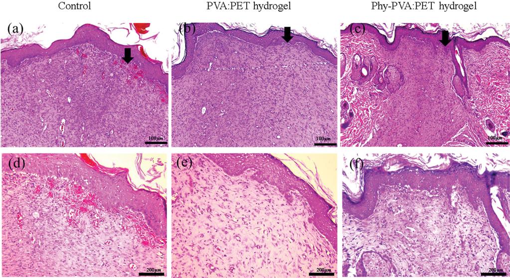 잣나무 부산물이 첨가된 창상피복재용 Poly(vinyl alcohol)/pectin 항균 하이드로젤의 평가 549 Figure 7. Histopathological studies, photograph 40 magnification (a, b, c) and 200 magnification(d, e, f) were at 20 days after injury.