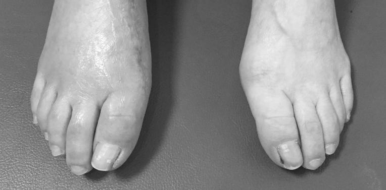 J Korean Obstet Gynecol Vol.28 No.2 May 2015 Fig. 2. Both feet image (3/27). Fig. 3. Both feet image (4/20). Table 2.