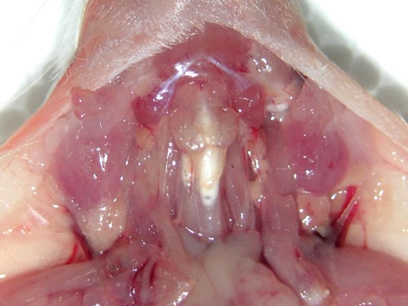 Removal of the central compartment of neck including skin and strap muscle exposes the trachea and thyroid gland. Thyroid glands are located on each side of trachea (arrows).