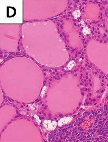 형질전환마우스표현형분석 Fig. 2. Representative figures of thyroid glands from wild type FVB/N mice. (A, B) Thyroid glands are composed of relatively round uniform follicles.