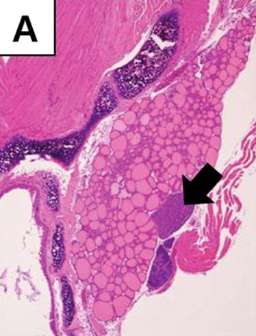 (D) Brown adipose tissues are scattered in the interfollicular space.