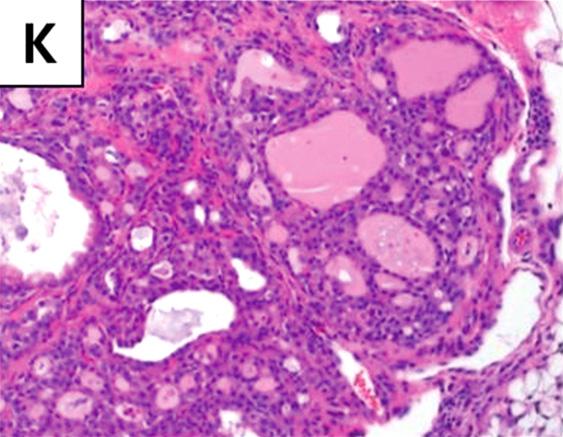 Mitoses are occationally found in follicular cell.