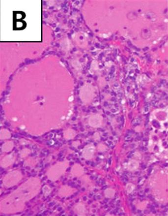 side of trachea. (B) Thyroid gland is composed of relatively round follicles.