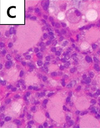 (C) Follicle consists of a cuboidal cell with a slightly enlarged, uniform nucleus.