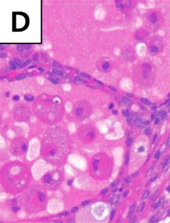 (E H) Thyroid glands of 20 weeks old mice.