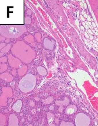 (G) Thyroid gland consists of variable sized and relatively irregular shaped follicles.