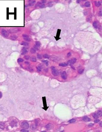 (H) Some of follicular cells have a cillia-like sturecture (arrows).
