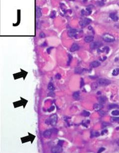 형질전환마우스표현형분석 Fig. 4. Representative figures of thyroid glands from 39 and 44 week old transgenic mice.