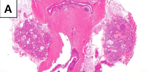 Both lobes of thyroid gland fuse in the midline of trachea.