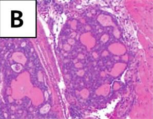 muscle. (C) Thyroid gland consists of variable sized and irregular shaped follicles.