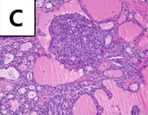 (D) Follicular cell consists of a variable shaped and sized cell.