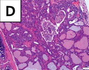 (F K) Thyroid glands of 44 weeks old mice. (F) Thyroid gland measures about 5 mm in the largest length.