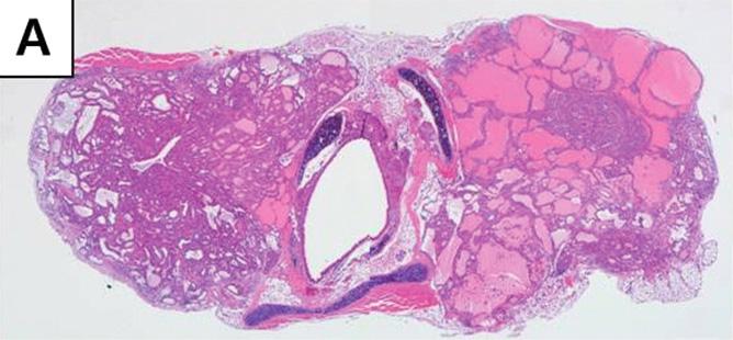 (A C) Thyroid glands of 48 weeks old mice. (A) Thyroid gland measures about 3.