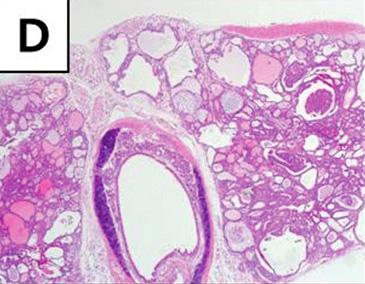 (D K) Thyroid glands and metastatic lung lesion of 60 weeks old mice.
