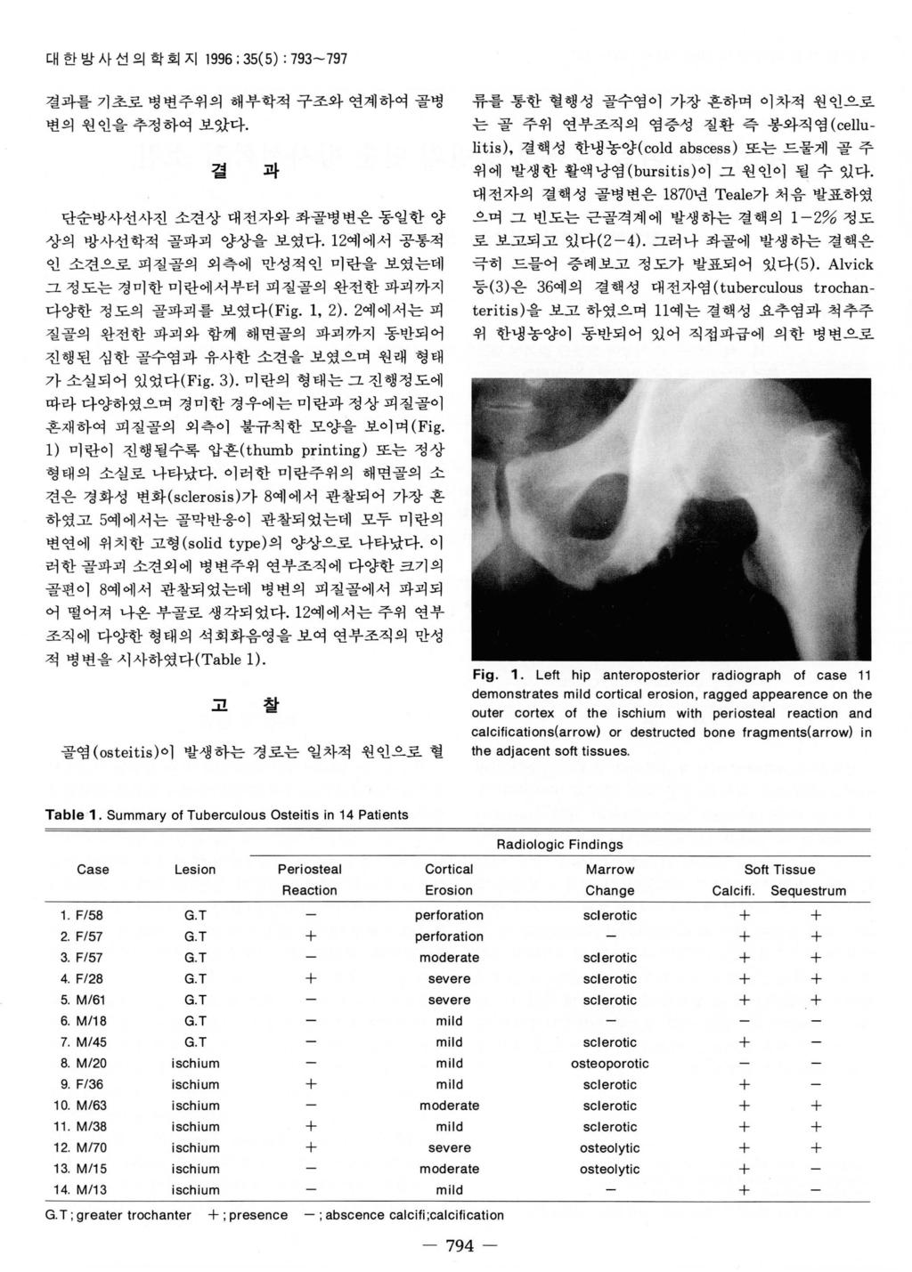 대한방사선의학회지 1996: 35(5) : 793-797 결과를기초로병변주위의해부학적구조와연계하여골병변의원인을추정하여보았다. 결과단순방사선사진소견상대전자와화골병변은동일한양상의방사선학적골파괴양상을보였다. 12예에서공통적언소견으로피질골의외측에만성적인미란을보였는데그정도는경미한미란에서부터피질골의완전한파괴까지다양한정도의골파괴를보였다 (Fig. 1, 2).