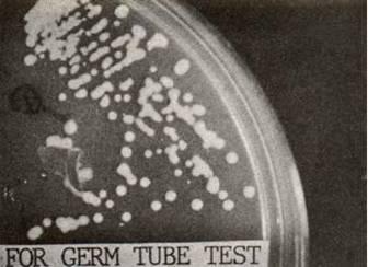 Fig. 13 : For the germ tube test the