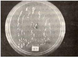 15 : Large numbers of yeast and hyphal