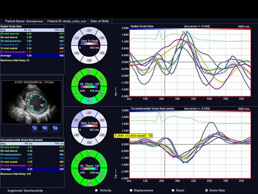 다양한 특수 기능들 (ECG, CUBE Strain, Stress Echo, Auto IMT,