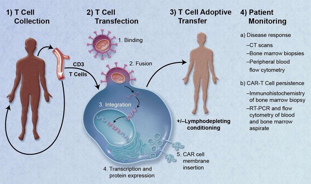 CAR-T cell therapy(chimeric Antigen Receptor):