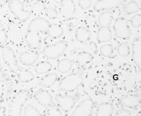 배은희외 3 인 : Effects of Antioxidant on Cisplatin Induced Nephropathy 161 Fig. 5. Apoptosis evaluated by TUNEL staining in the kidney sections from different groups of rats.