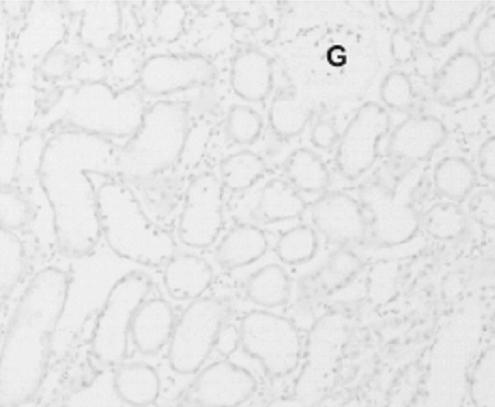 20 신조직내로유입된대식세포는 TNF-α와같은염증성 chemokine과 cytokine의합성을촉진하고, 단백분해효소를분비하여세뇨관세포들을활성화시킨다. 활성화된세포들이다시염증성매개체를분비하여그결과신손상이더욱악화된다. 본연구에서도대식세포의표지자인 ED-1이 cisplatin에서증가, α-la 투여로호전되었다.