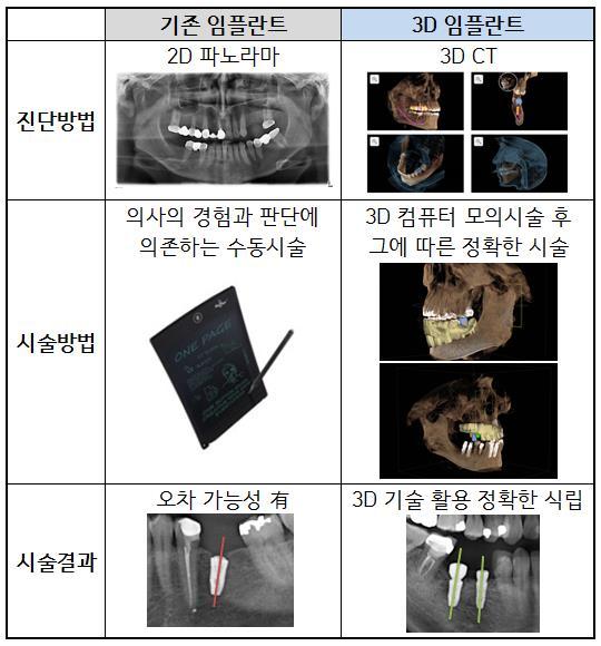 치아가손실됐어요!