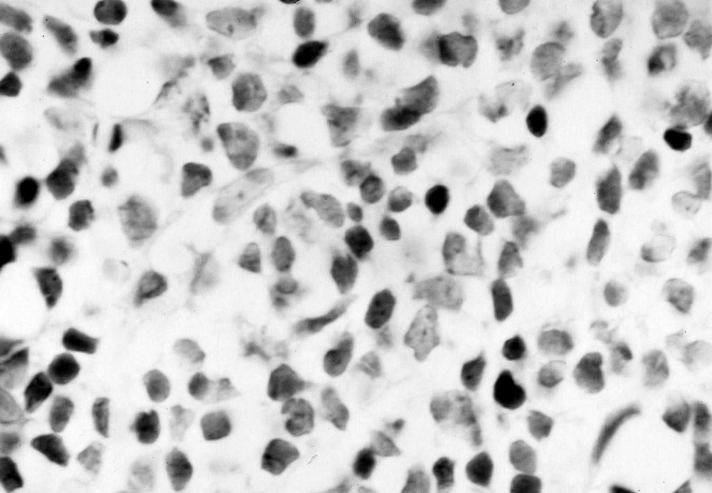 The cytoplasms of prolymphocytes are relatively more abundant than that of small mature lymphocytes.