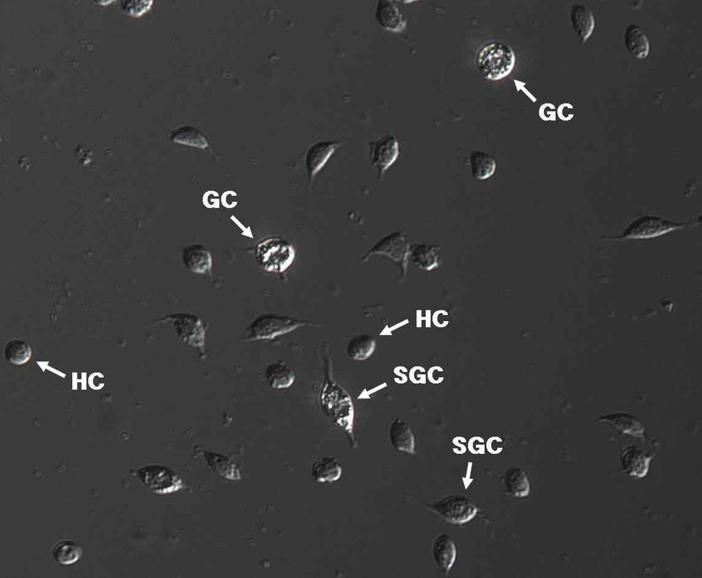 그림 39. 위상차현미경에의한헤모사이트의사진, GC: granular cell; HC: hyaline cell; SGC: semigranular cell. Fig. 39. Hemocyte in phase-contrast light microscopy.