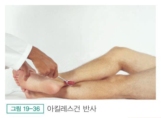 p531 아킬레스건반사 (achilles reflex, ankle jerk L5~S2) 방법 : 대상자는무릎을구부린자세로둔부를외측으로회전발을배굴자세