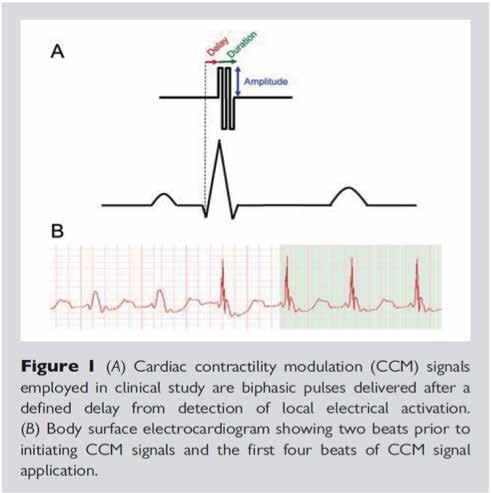 device implant 그림 2. Cardiac contractility modulation (CCM) 의기전및효과 럽심부전학회에서도좋은결과가발표되었다.