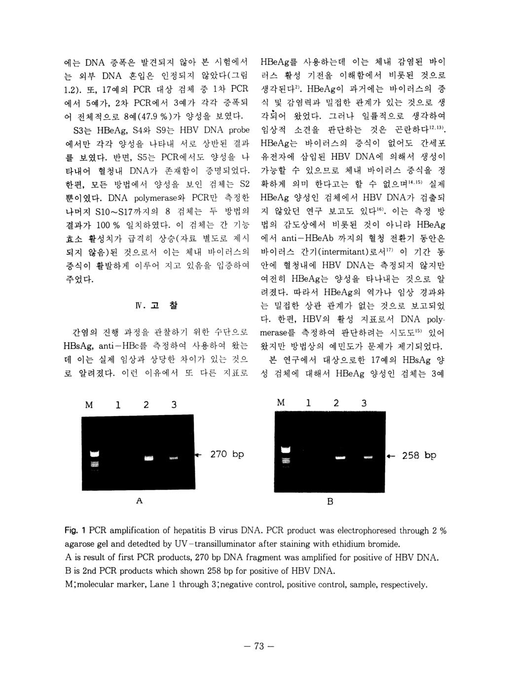 에는 DNA 증폭은발견되지않아본시험에서 HBeAg 를사용하는데이는체내 감염된바이 는외부 DNA 혼입은인정되지않았다 ( 그림 1.2). 또, 17 예의 PCR 대상검체중 1 차 PCR 에서 5 예가, 2 차 PCR 에서 3 예가각각증폭되어전체적으로 8 예 (47.9 %) 가양성을보였다. 러스활성기전을이해함에서비롯된것으로생각된다 2).