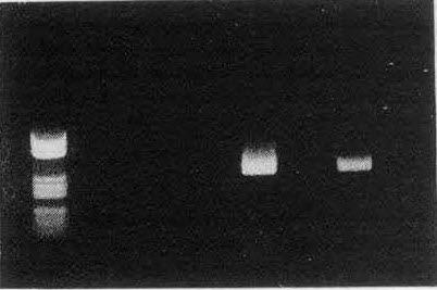 반면, 5 는 PCR에서도양성을나유전자에삽입된 HBV DNA 에의해서생성이타내어혈청내 DNA 가존재함이증병되었다. 가능할수있으므로체내바이러스증식을정 한편, 모든방법에서양성을보인겸제는 2 확하게의미한다고는할수없으며 14, 15) 실제 뿐이였다.