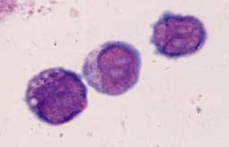 20 U/mL 10 U/mL 3 U/mL 3 steps 0 0 5 10 15 20 25 Day of culture Fig. 2. The mean cell expansion according to culture days and conditions.