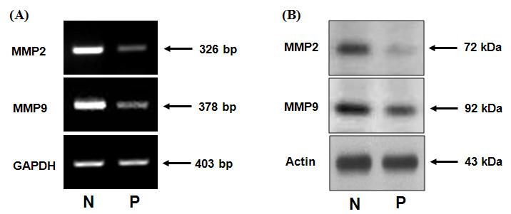 대한산부회지제 51 권제 11 호, 2008 5) 면역조직화학염색법 (immunohistochemistry) 10% 중성포르말린용액에고정하고, 파라핀조직을 4 μm의두께로절편 (section) 을만들어 xylene 으로 15분간탈파라핀화하고 10%, 90%, 70% 의알코올을각 3분씩거쳐증류수로함수 (rehydration) 시켰다.